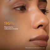 Exfoliate Bio Cellulose Mask