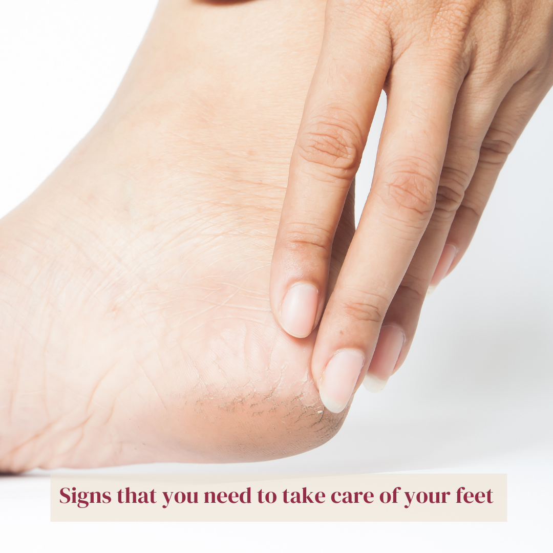 Signs that you need to take care of your feet