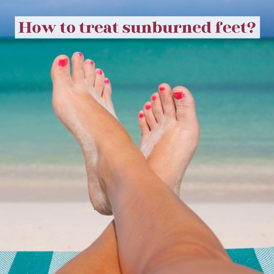 How to treat sunburned feet?