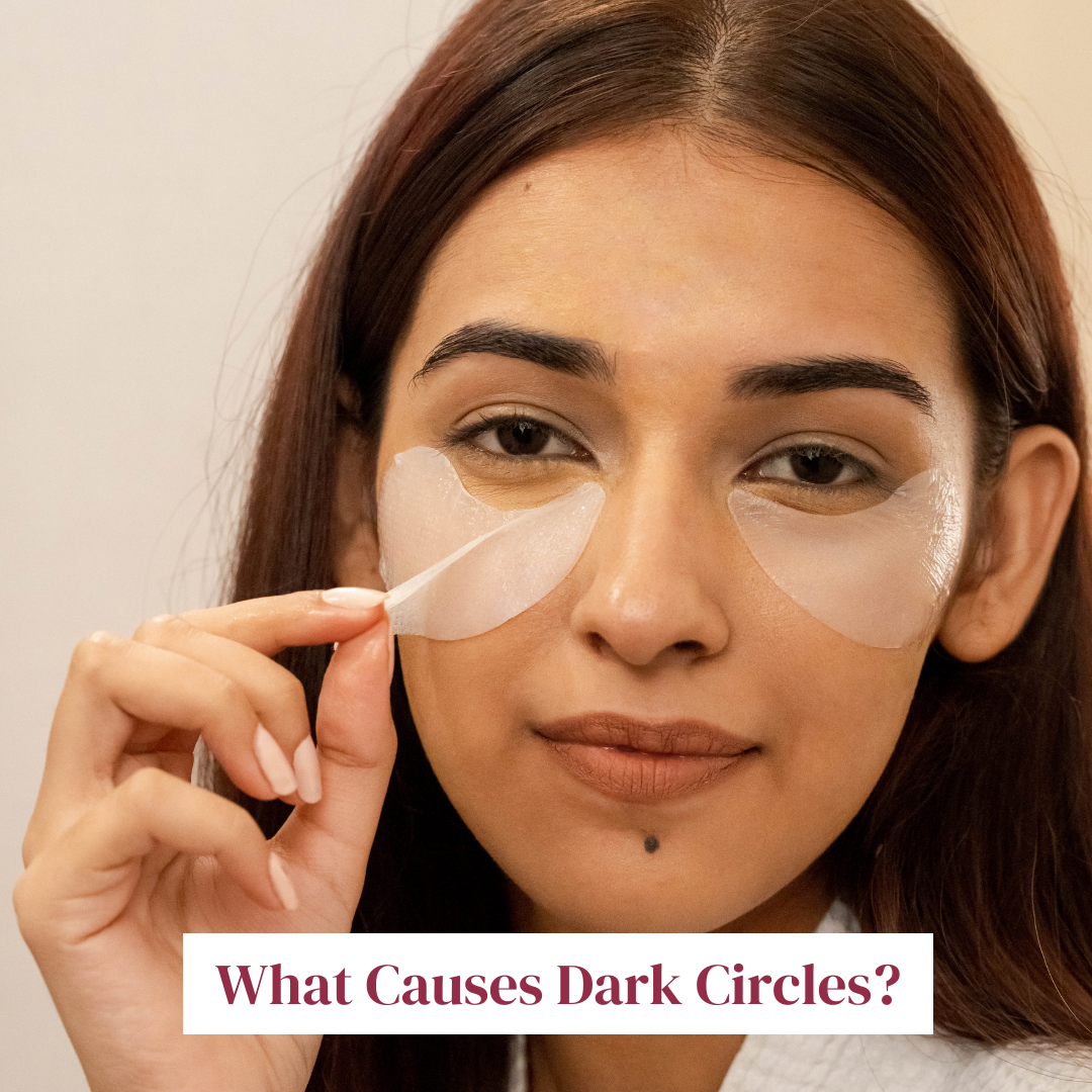What causes dark circles?
