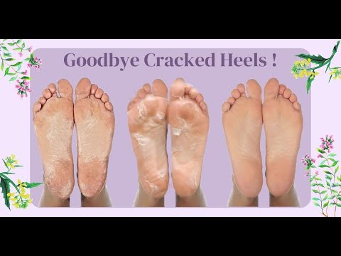 Peeling & Exfoliating Foot Mask